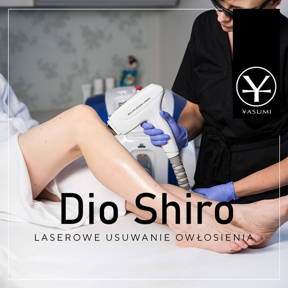 Portfolio usługi Laser Diodowy Dio Shiro