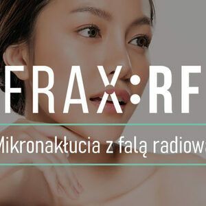 Portfolio usługi Frax:RF - mikronakłucia z falą radiową -  Blizn...
