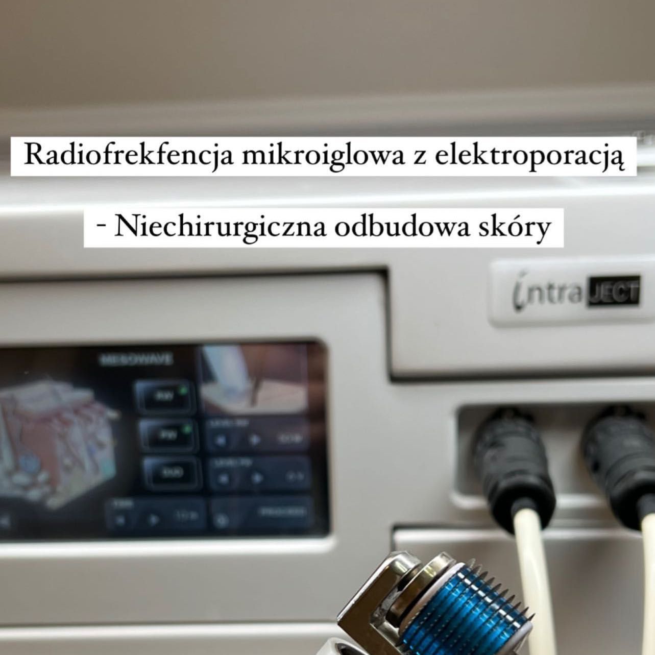 Portfolio usługi RF mikroigłowy z elektroporacją TWARZ+osocze+fibry