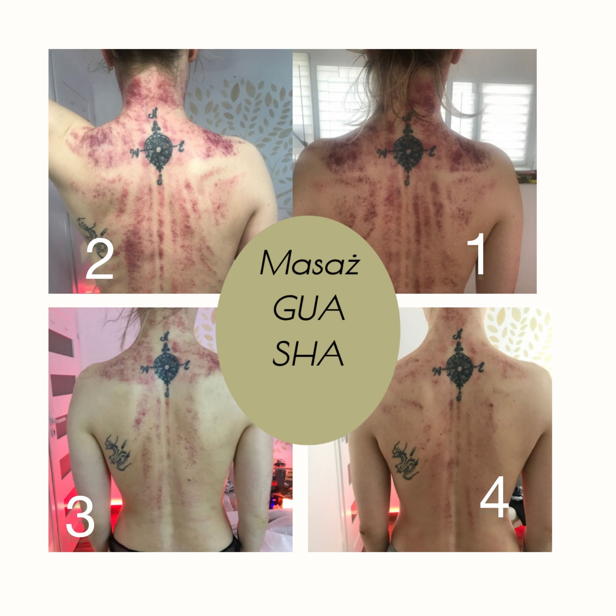 Portfolio usługi Chiński masaż leczniczy diagnostyczny GuaSha