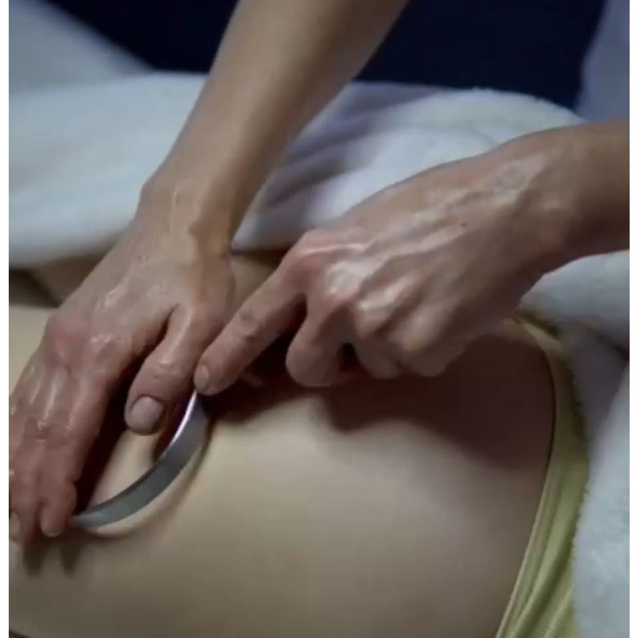 Portfolio usługi Chiński masaż antycellulitowy GuaSha