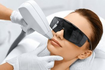 Portfolio usługi Depilacja twarzy laserem / Лазерна депіляція лиця