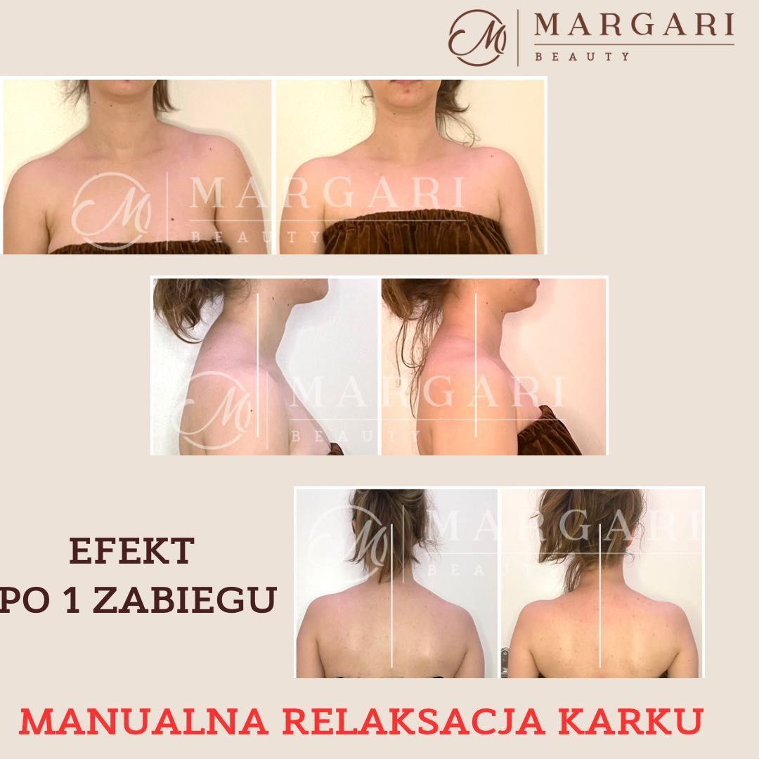 Portfolio usługi Manualna relaksacja karku Margari Beauty