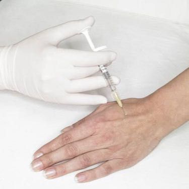 Portfolio usługi Mezoterapia igłowa dłoni