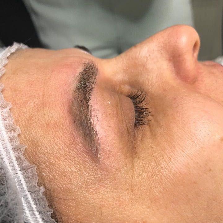 Portfolio usługi Laserowe usuwanie makijażu permanentnego brwi