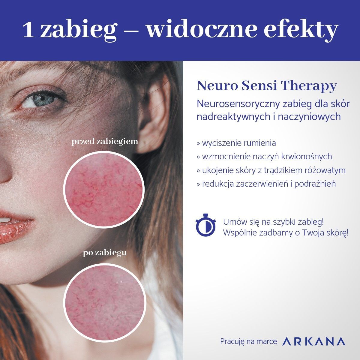 Portfolio usługi Arkana Neuro Sensi -zabieg dla skór nadreaktywnych