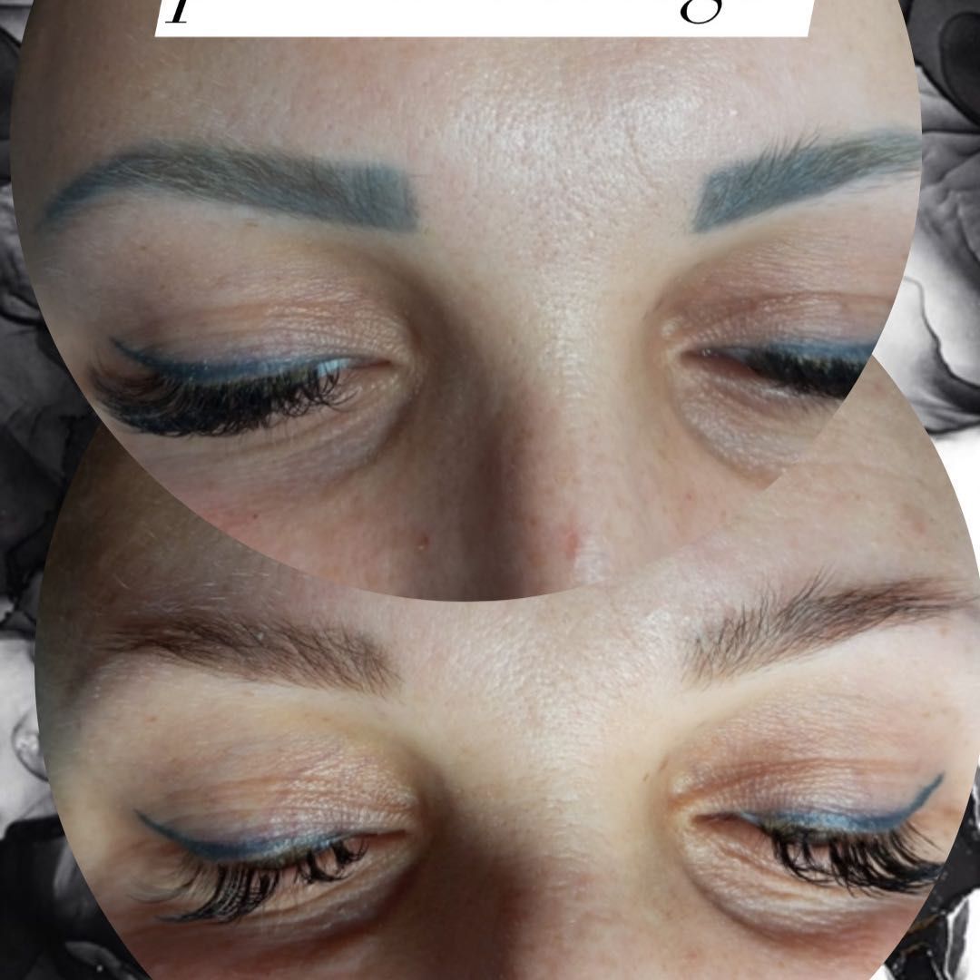 Portfolio usługi Laserowe usuwanie makijażu permanentnego