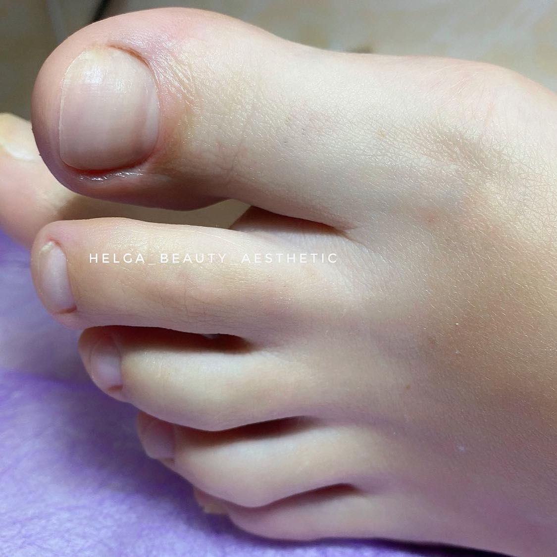 Portfolio usługi usuwanie lakieru hybrydowego+pedicure palce+stopy