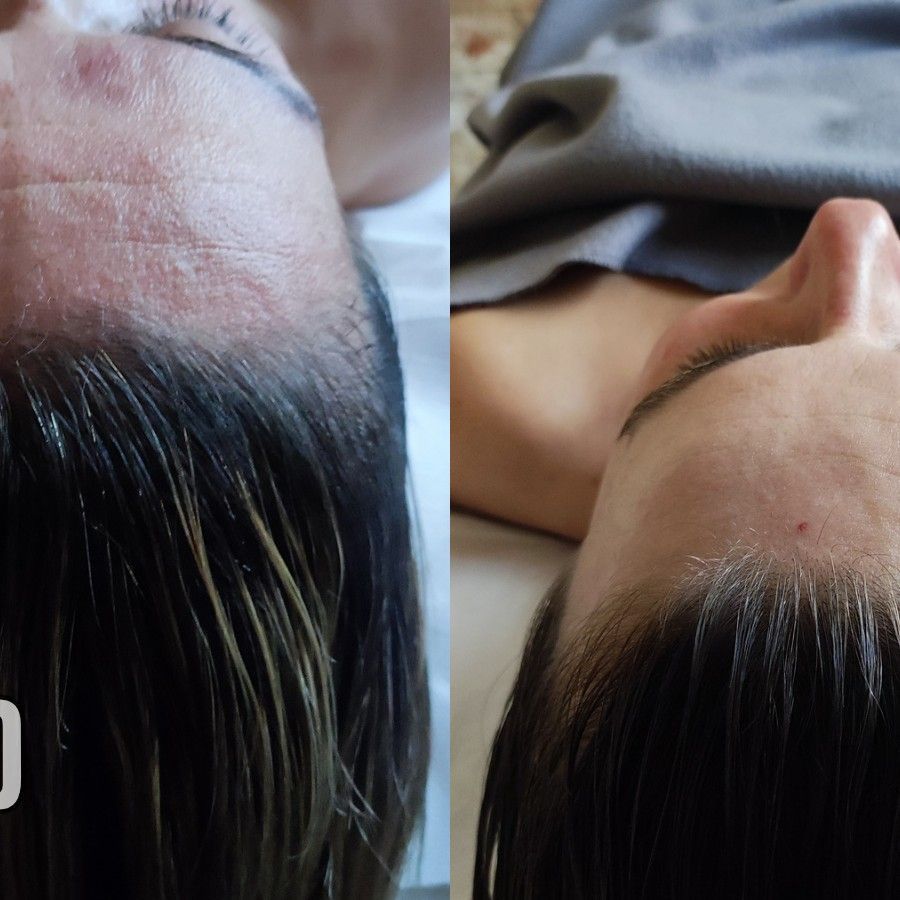 Portfolio usługi Japoński masaż twarzy KOBIDO