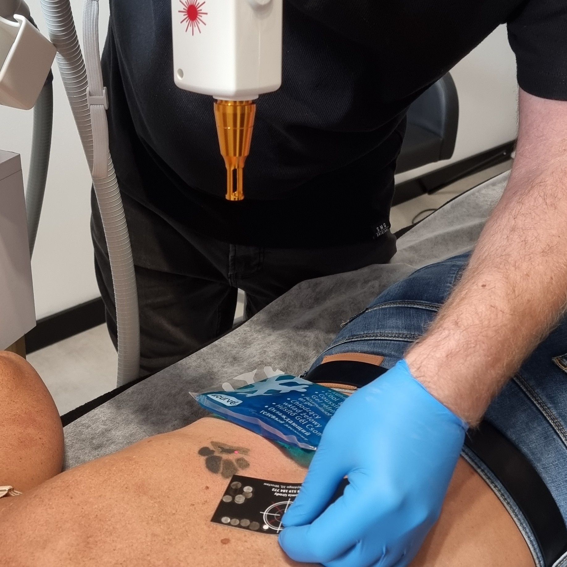 Portfolio usługi Laserowe usuwanie tatuażu - promocja