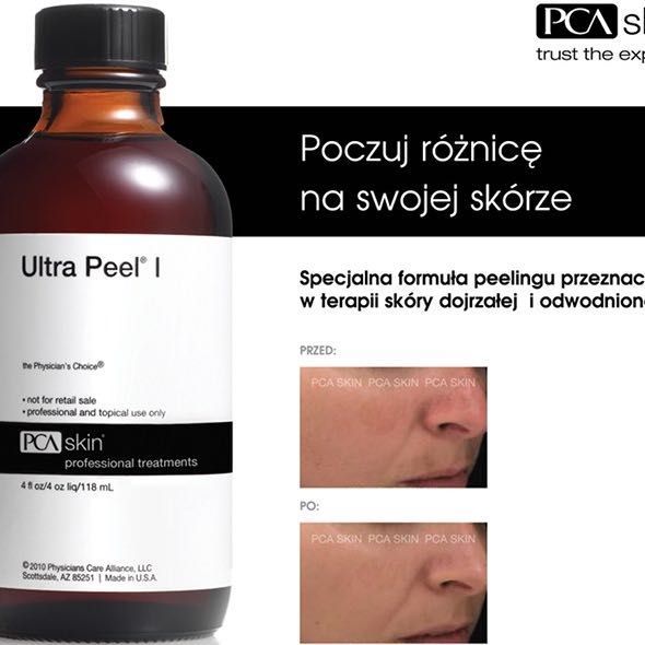Portfolio usługi Ultra Peel PCA Skin