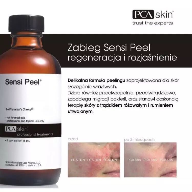 Portfolio usługi Sensi Peel PCA Skin