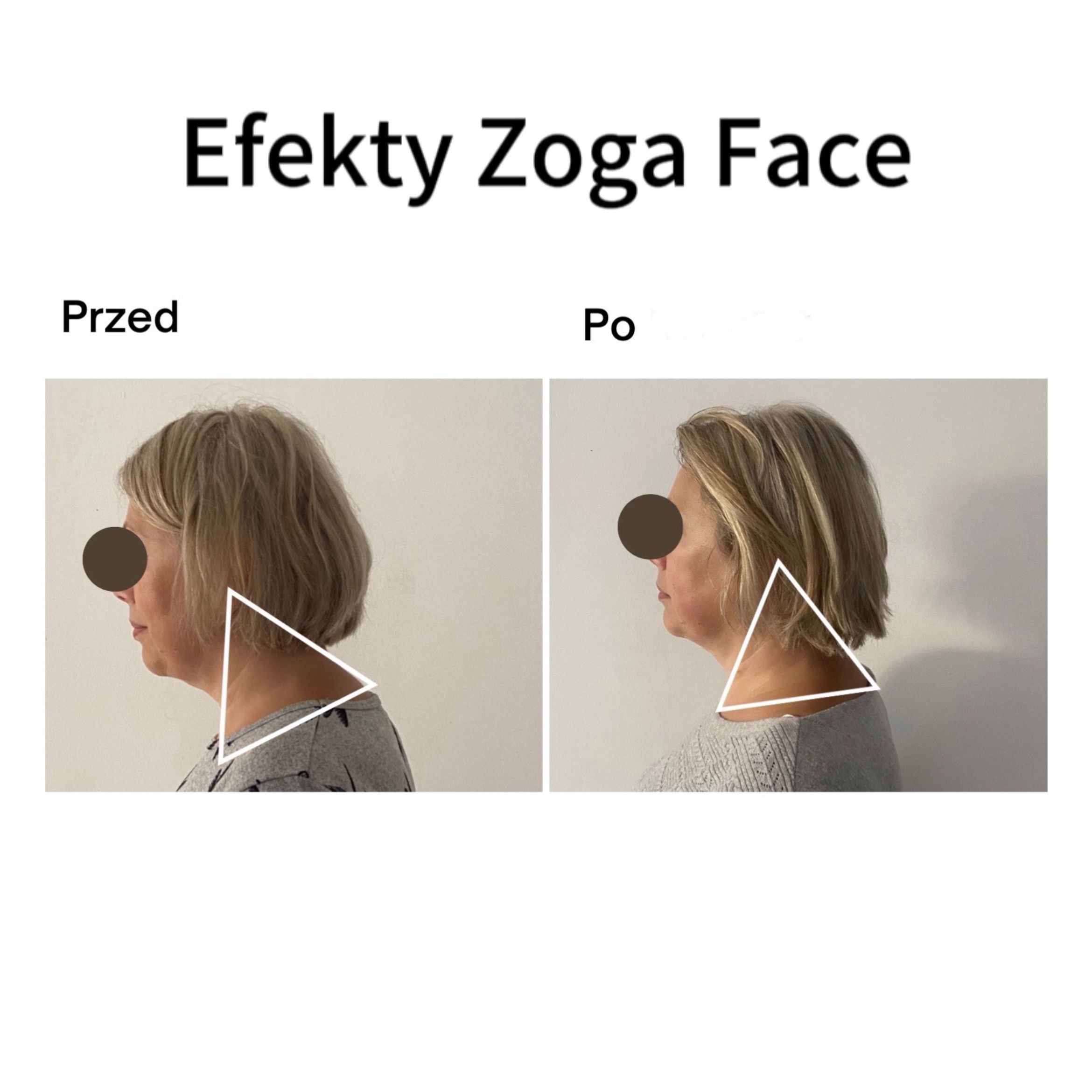 Portfolio usługi Zoga Face Integration