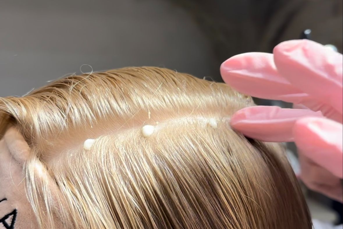 Portfolio usługi Peeling skóry głowy - skóra wrażliwa
