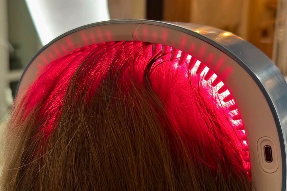 Portfolio usługi Allaya Hair Shot - dermapen + laser LLLT