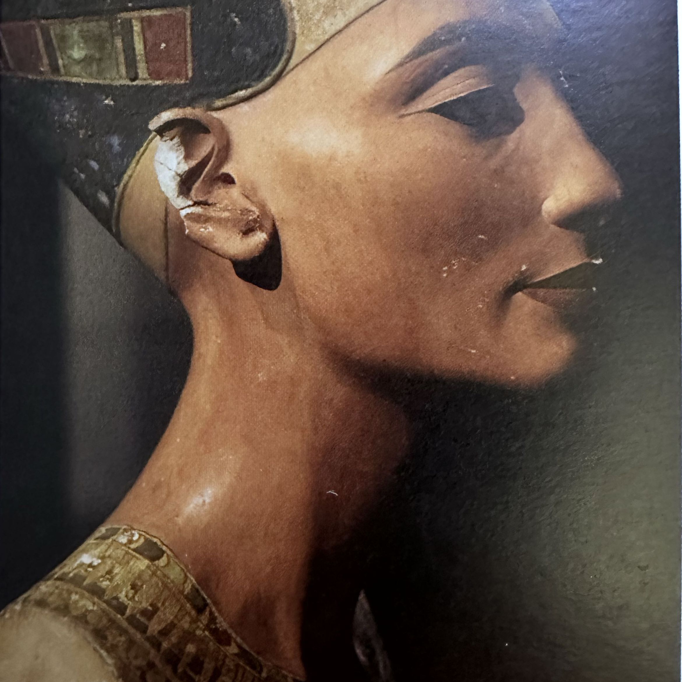 Portfolio usługi Botoks lifting Szyi Nefertiti