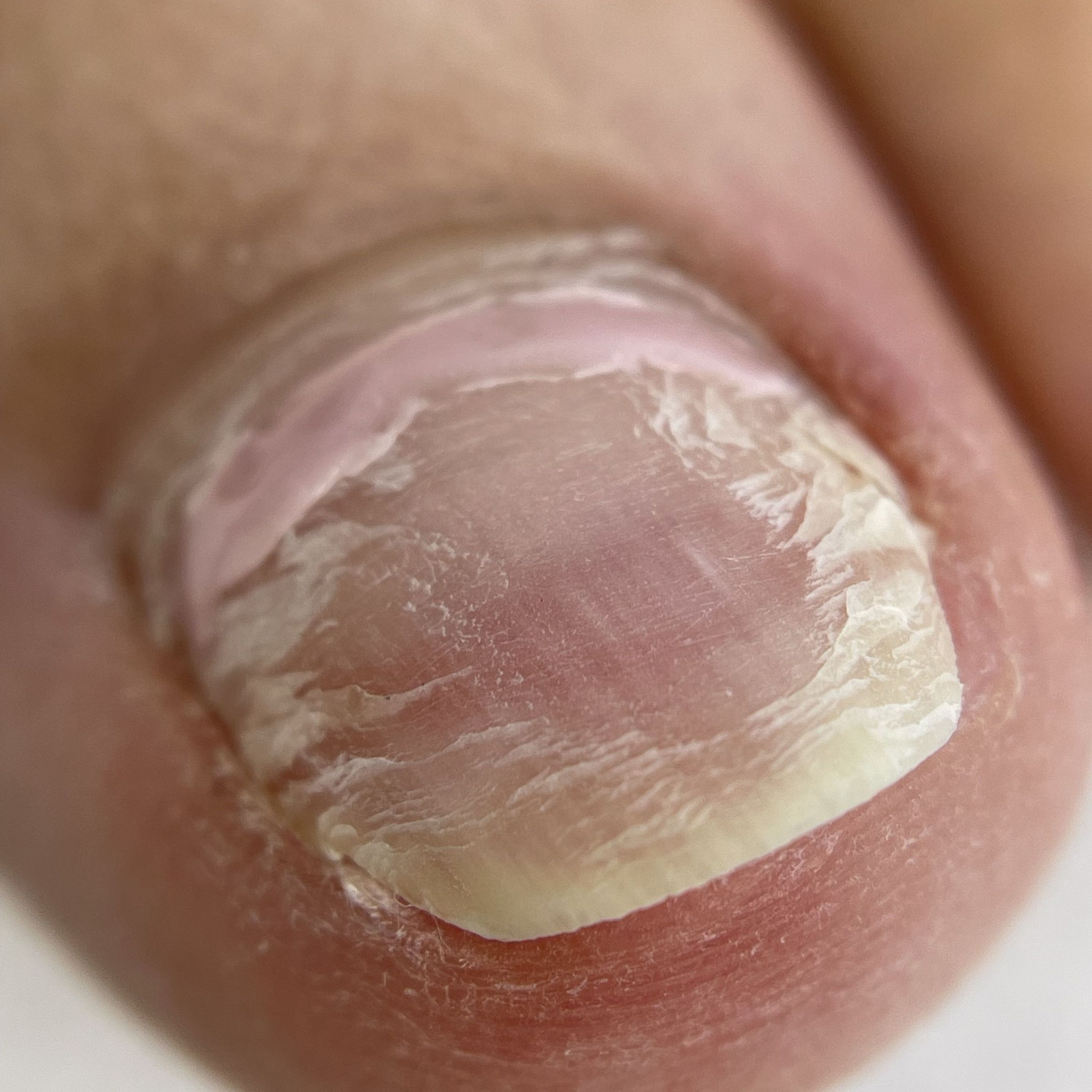 Portfolio usługi Naprawa paznokcia w trakcie zabiegu