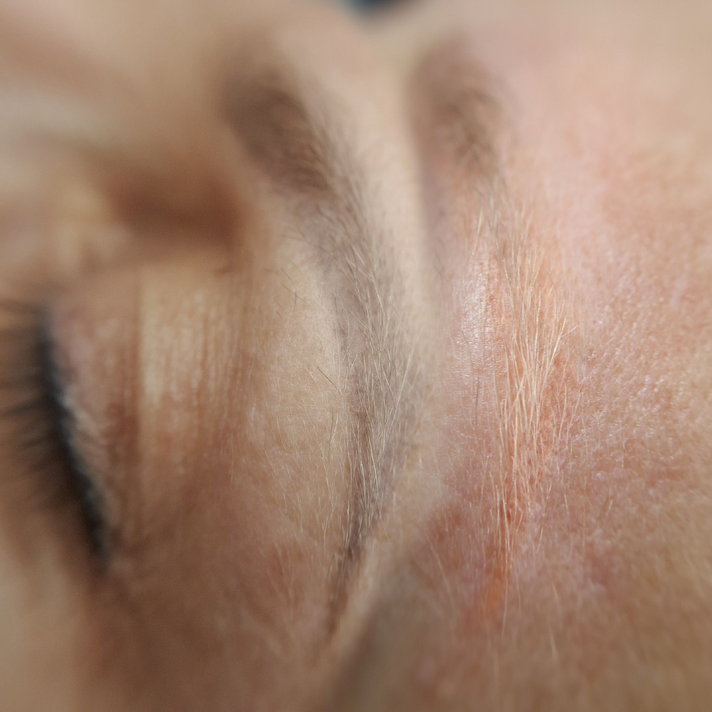 Portfolio usługi Usuwanie laserowe makijażu permanentnego