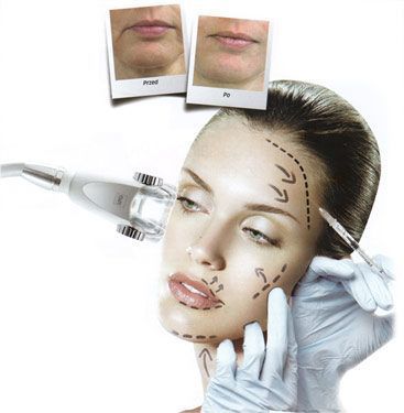 Portfolio usługi Edermologia LPG na twar Facemassage