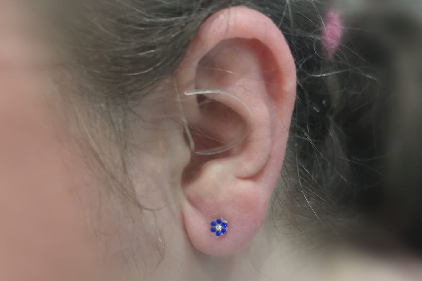 Portfolio usługi Przekłuwanie uszu dzieciom Blomdahl oboje uszu