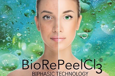 Portfolio usługi Peeling BioRePeelCl3 FND - twarz + szyja + dekolt