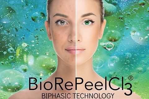 Portfolio usługi Peeling BioRePeel FND - twarz