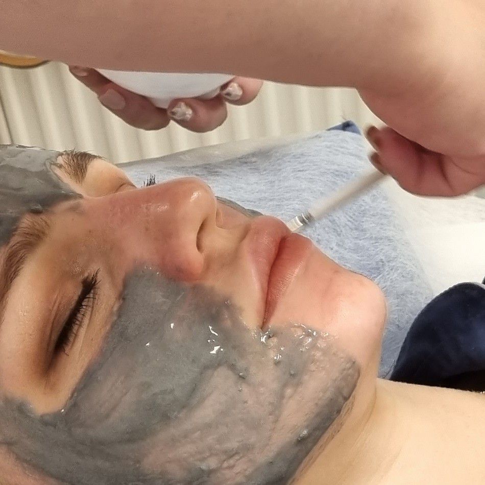 Portfolio usługi Dermatologiczny resurfacing skóry twarzy