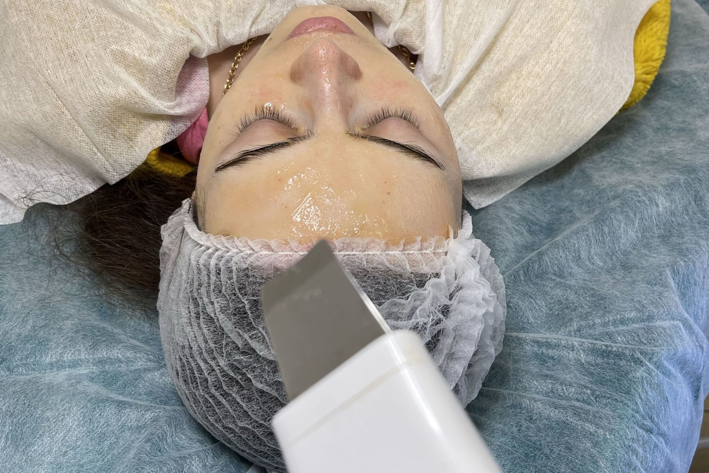 Portfolio usługi Głębokie oczyszczanie twarzy- peeling kawitacyjny