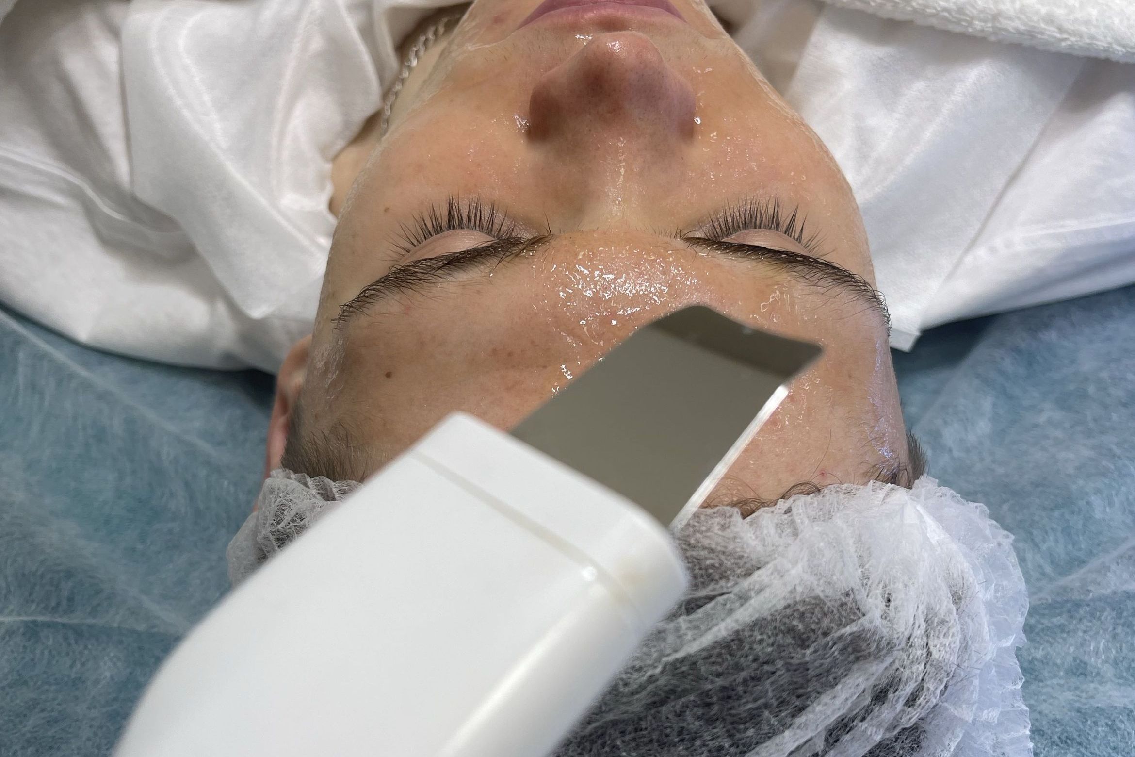 Portfolio usługi Głębokie oczyszczanie twarzy- peeling kawitacyjny