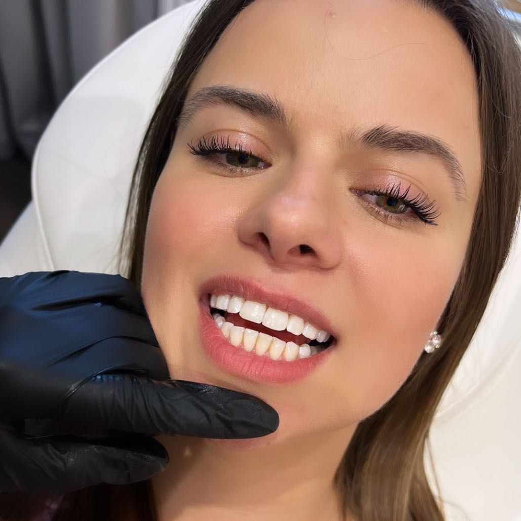 Portfolio usługi Kosmetyczne wybielanie zębów