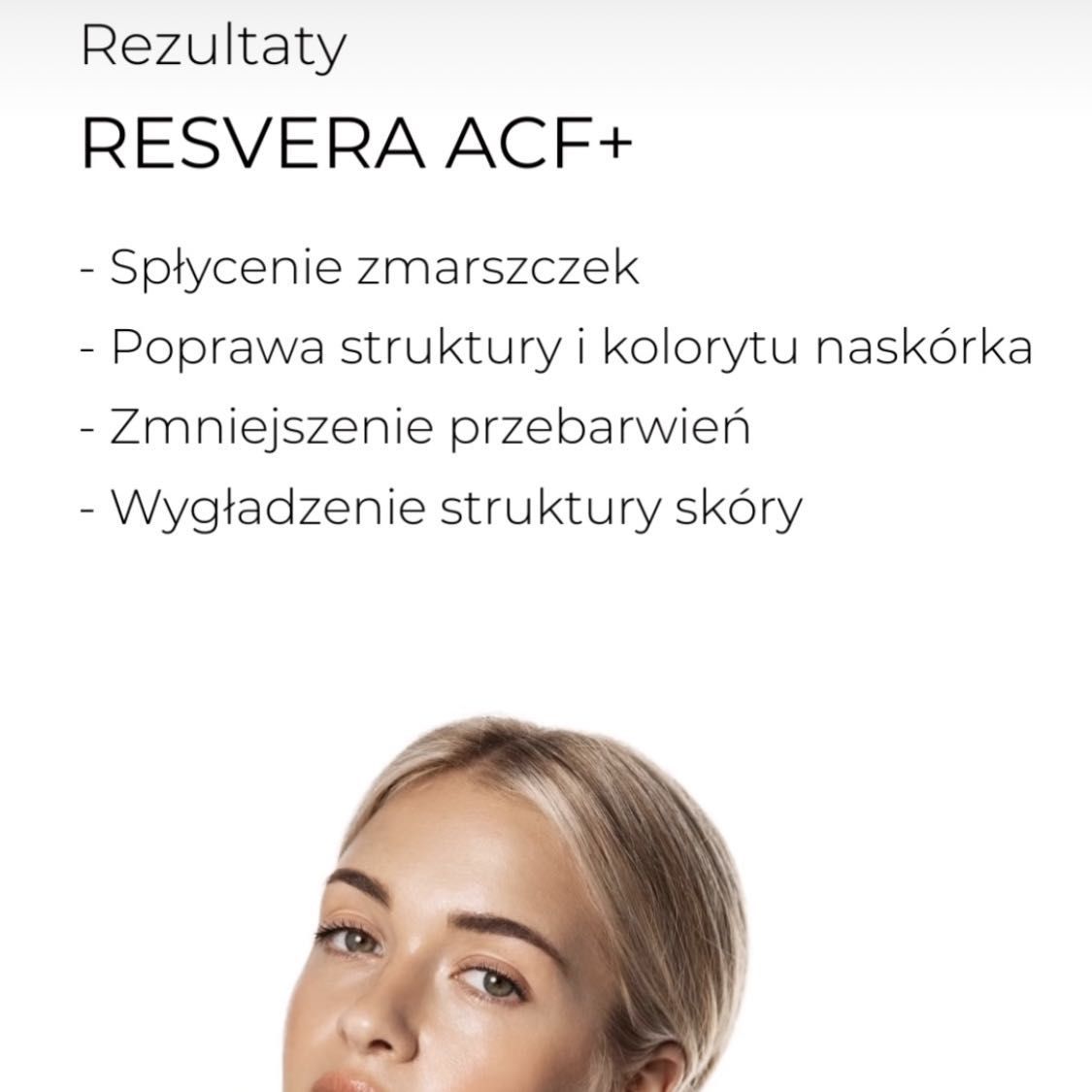 Portfolio usługi Resvera ACF+  Teapia odmładzająca z retinolem