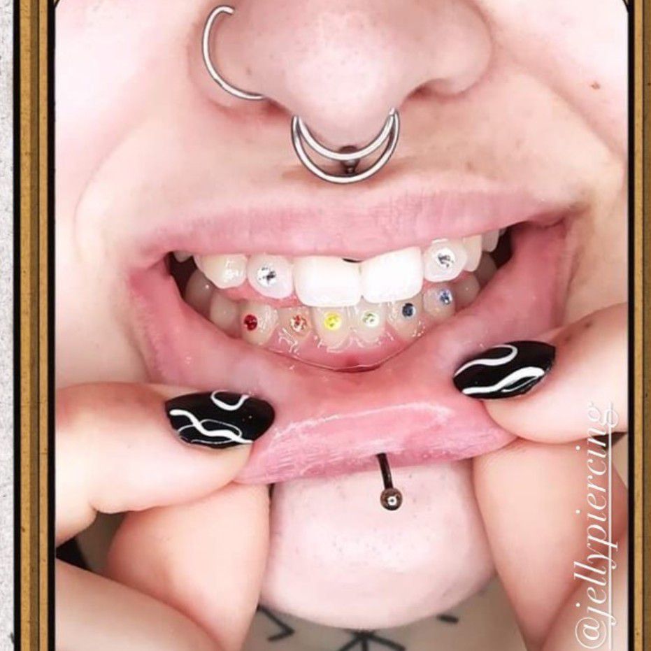 Portfolio usługi Tooth Gems Jelly Piercing