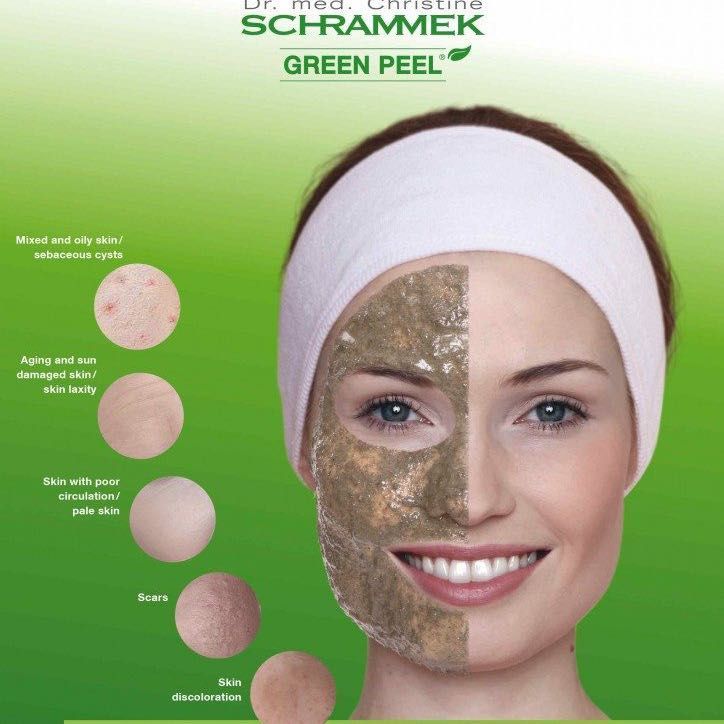 Portfolio usługi Green Peel Dr. Schrammek - twarz