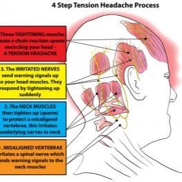 Portfolio usługi Terapia na napięciowy i migrenowy ból głowy