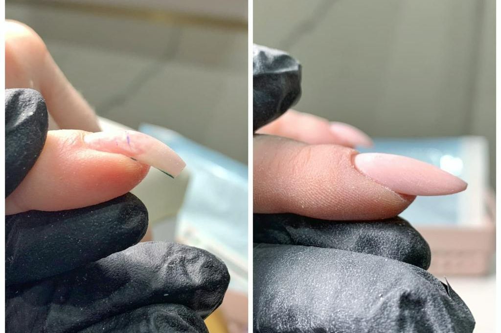 Portfolio usługi Rekonstrukcja obgryzionych paznokci