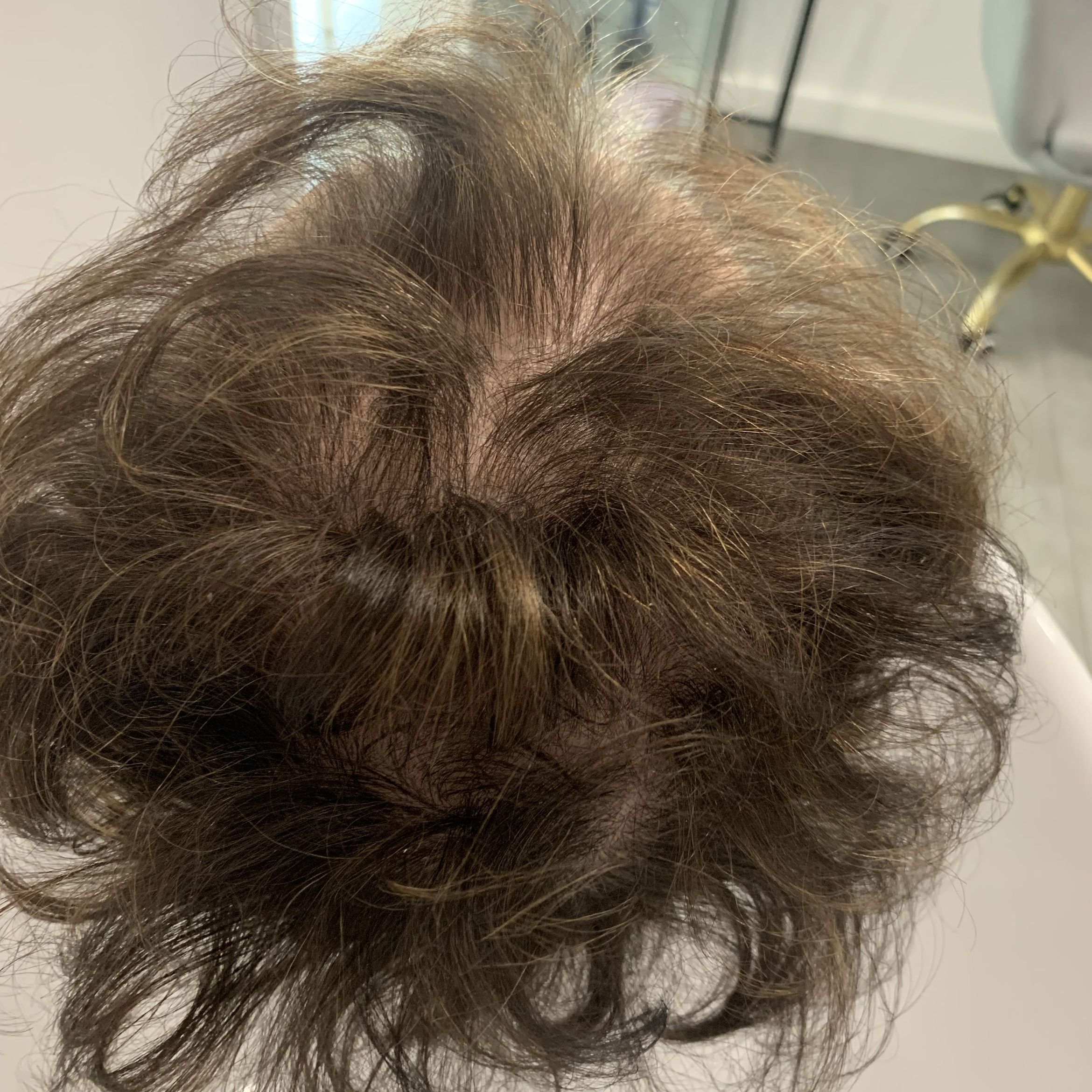 Portfolio usługi Laseroterapia z serum wzrostu włosów