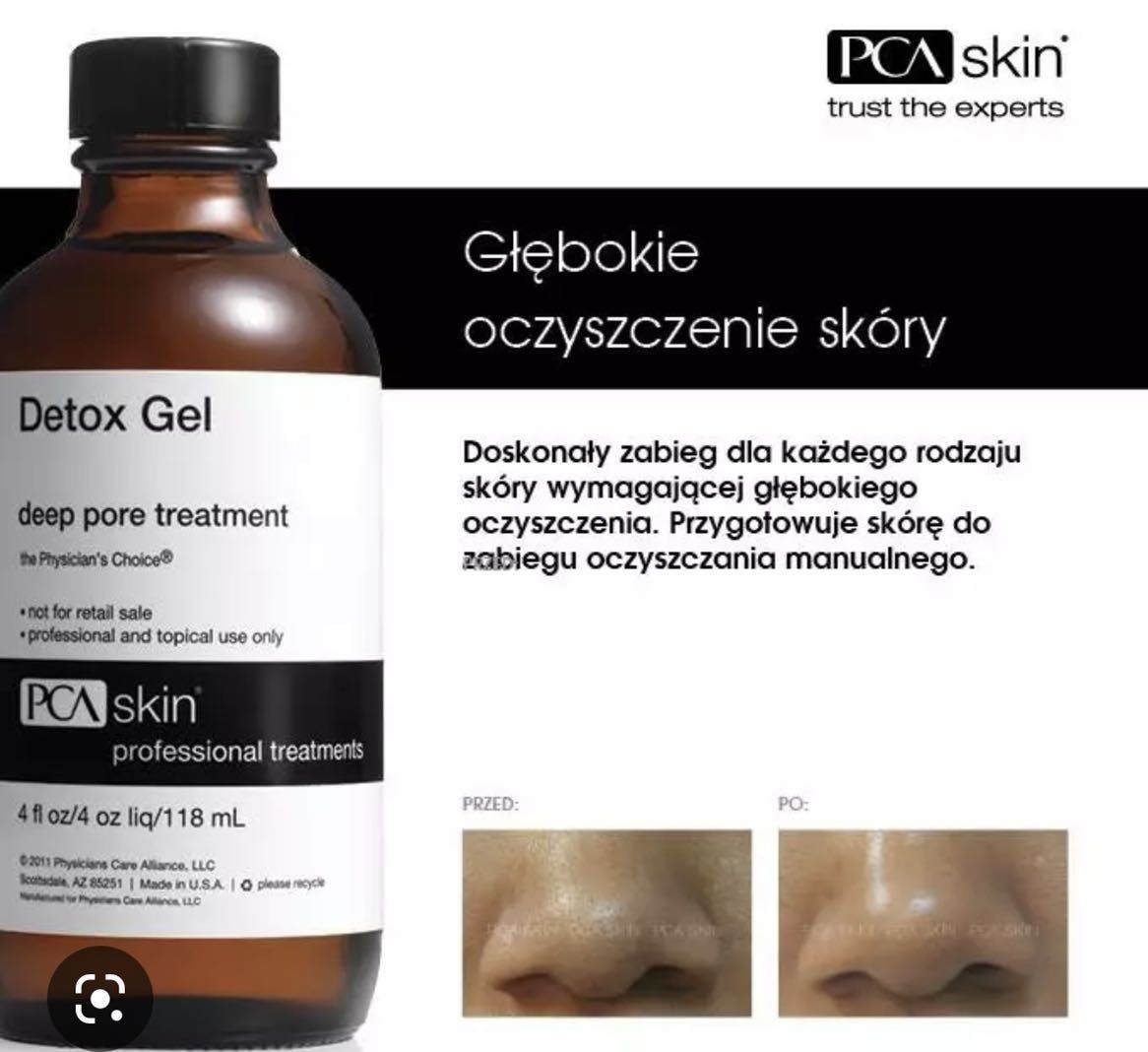 Portfolio usługi Pca Skin detox Gel.