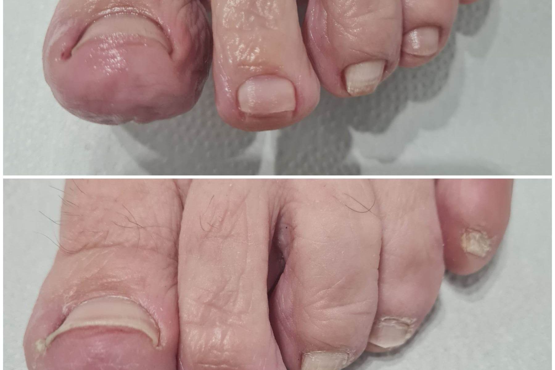 Portfolio usługi Obcięcie i oczyszczenie paznokci