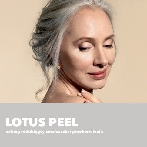 Portfolio usługi Lotus Peel- głęboki zabieg przeciwzmarszczkowy
