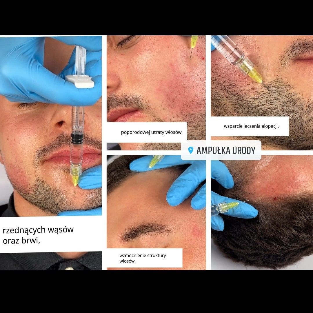 Portfolio usługi Zagęszczanie brody i włosów u mężczyzn