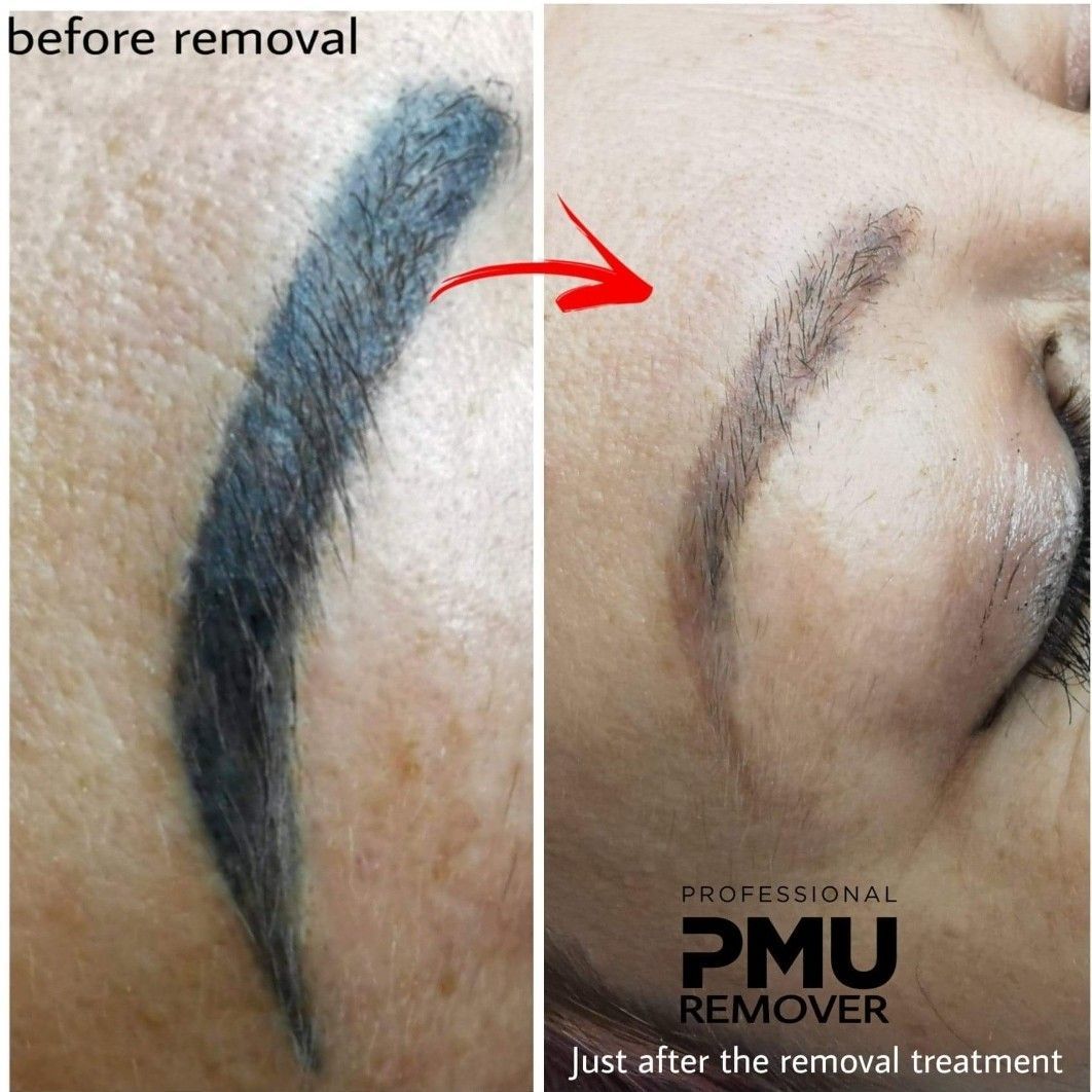 Portfolio usługi Usuwanie makijażu permanentnego remover