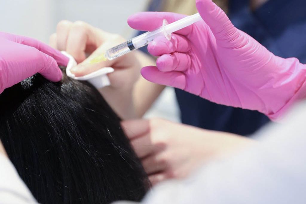 Portfolio usługi Dr Cyj Hair Filler - terapia wypadania włosów