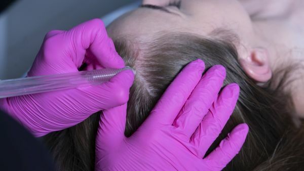 Portfolio usługi Laktooksybrazja skóry głowy z infuzją tlenową