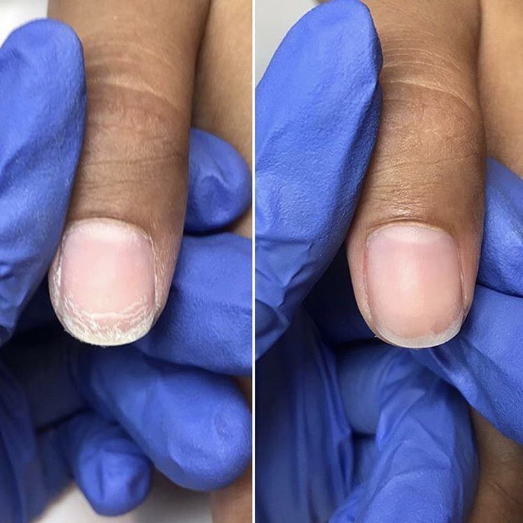 Portfolio usługi IBX regeneracja paznokci bez manicure