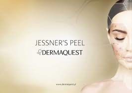 Portfolio usługi JESSNER'S PEEL- kuracja dla skóry z łojotokiem,...