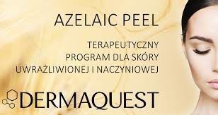 Portfolio usługi AZELAIC PEEL - zabieg dla skóry wrażliwej, nacz...