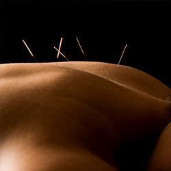 Portfolio usługi Akupunktura - pierwsza wizyta