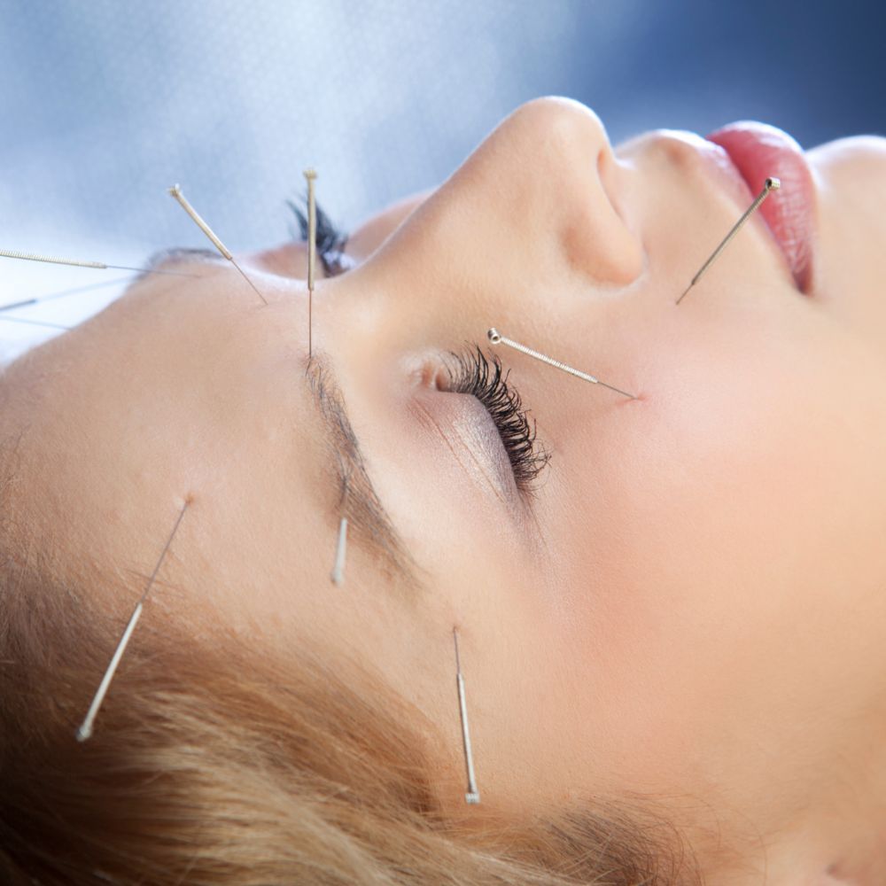 Portfolio usługi Akupunktura enterodermalna twarzy lub szyi i de...