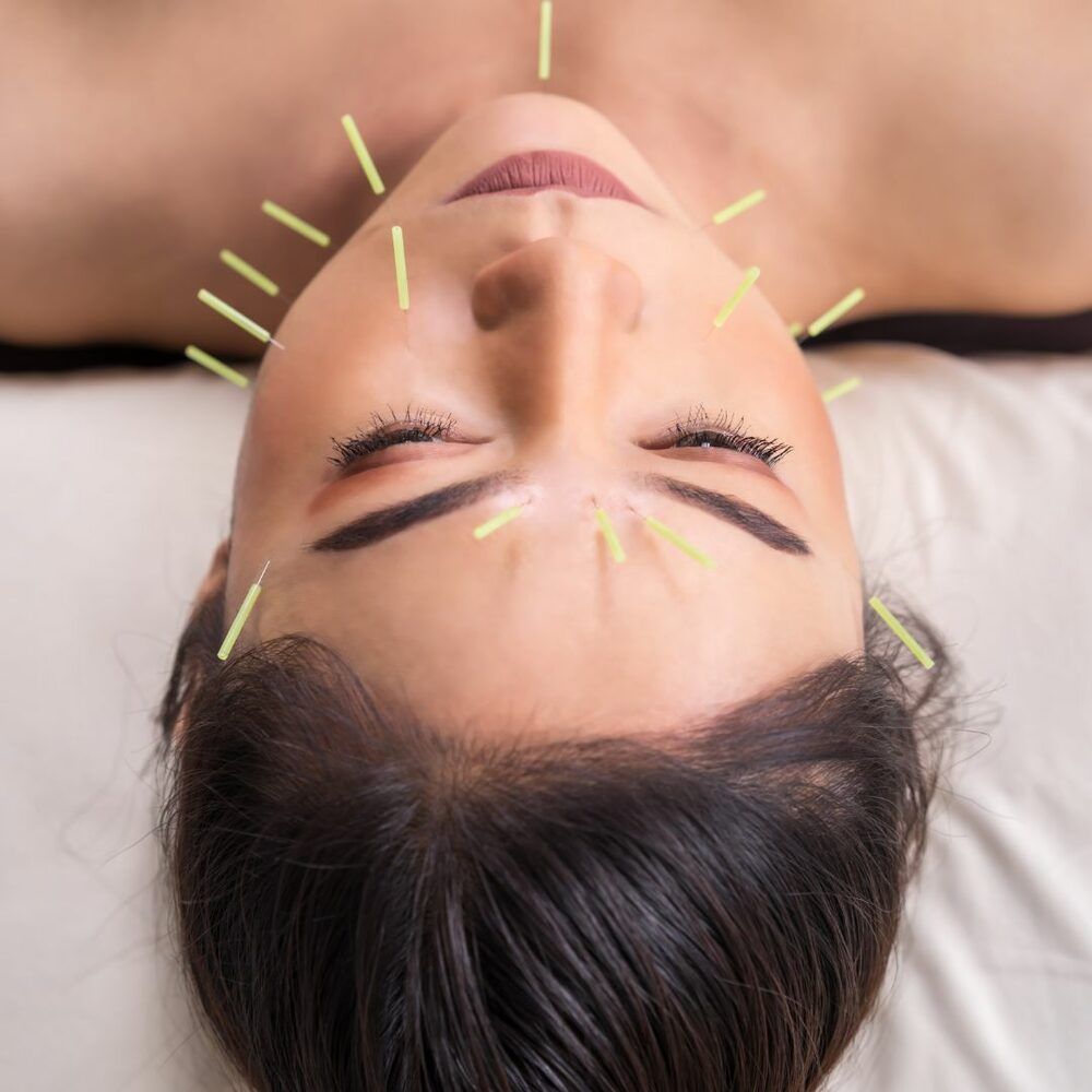 Portfolio usługi Akupunktura twarzy - 100 punktów piękności (PAK...