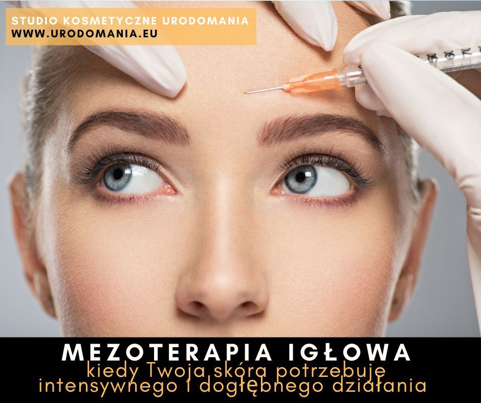 Portfolio usługi Mezoterapia igłowa - korekcja całej twarzy